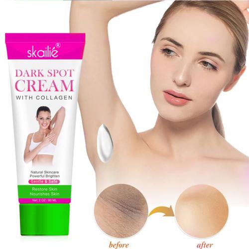Collagen Dark Spot Remover Cream